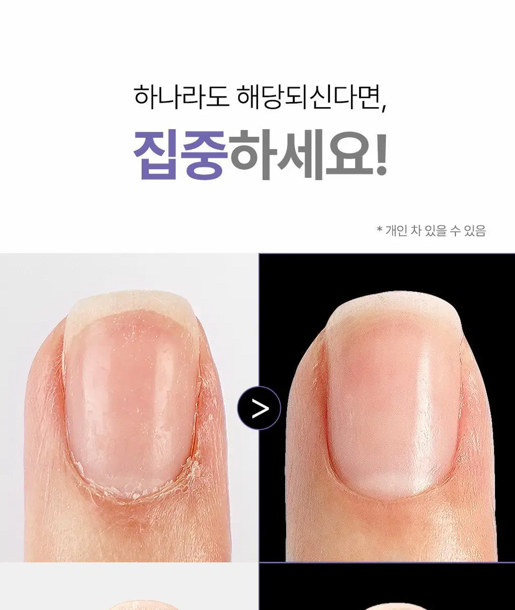 [대용량] 위드샨 네일&큐티클 오일펜 올케어 세트 (4ml x 4ea) 상세페이지 2